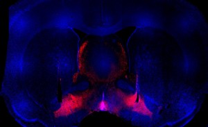 rat brain