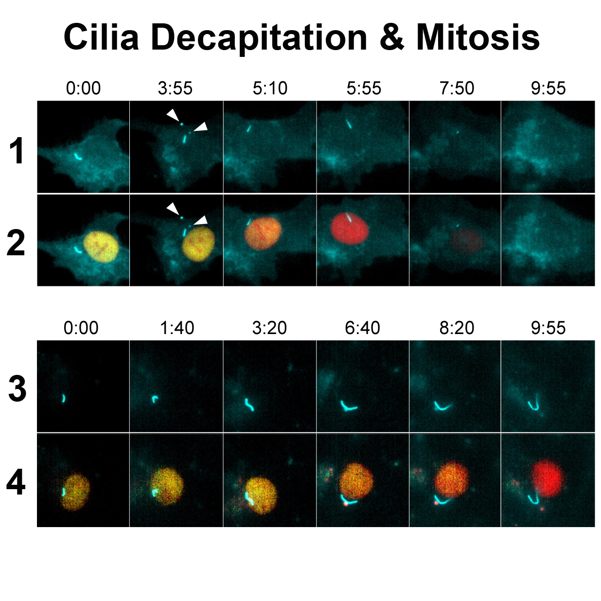 In normal cells (top panels), cilia decapitation (minute 3:55) usually occurs while cells are in the quiescent state (yellow nuclei) before they transition into mitosis (dark nuclei, minute 7:50). When cilia are prevented from forming “actin wires” (bottom panels), they are also unable to decapitate, causing their cells to transition more slowly from quiescence to mitosis. Credit: Courtesy of Cell Press