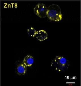 mAb43 (yellow) in beta cells. Credit: Dax Fu lab, Johns Hopkins Medicine